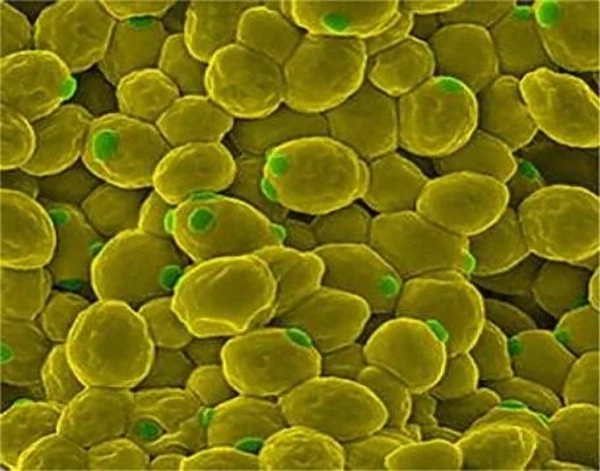 Ultrasonic Cell fragmentation 2 Ultrasonic Cell fragmentation 2